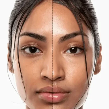 Is Your Skin Fatigued? Symptoms of Damage and Natural Repair Options